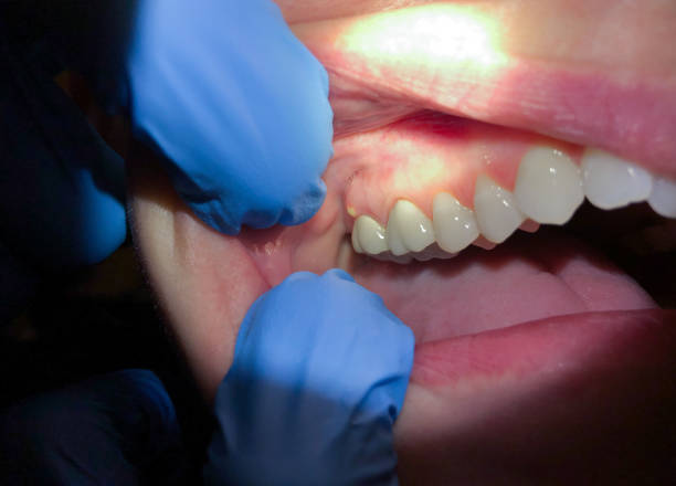 Best Pediatric Emergency Dentist in Evanston, WY
